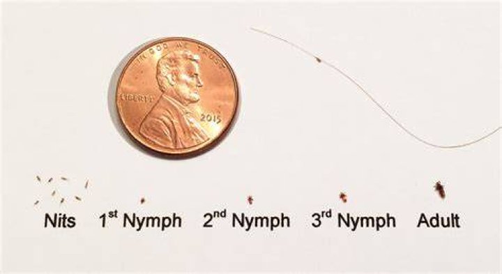 Are lice nits hard or soft?