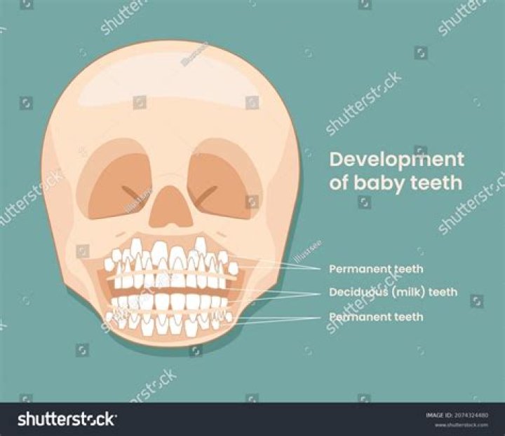 Are we born with teeth in your skull?
