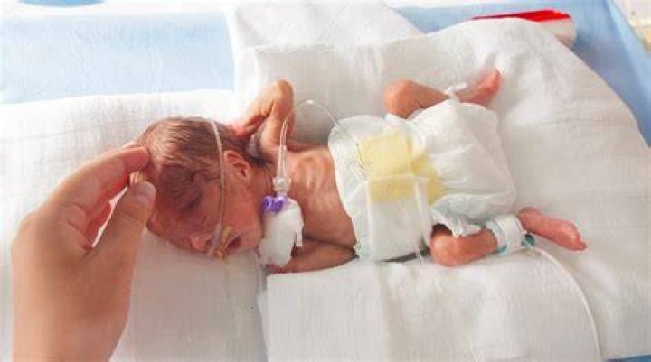 Can a baby survive without an umbilical cord?