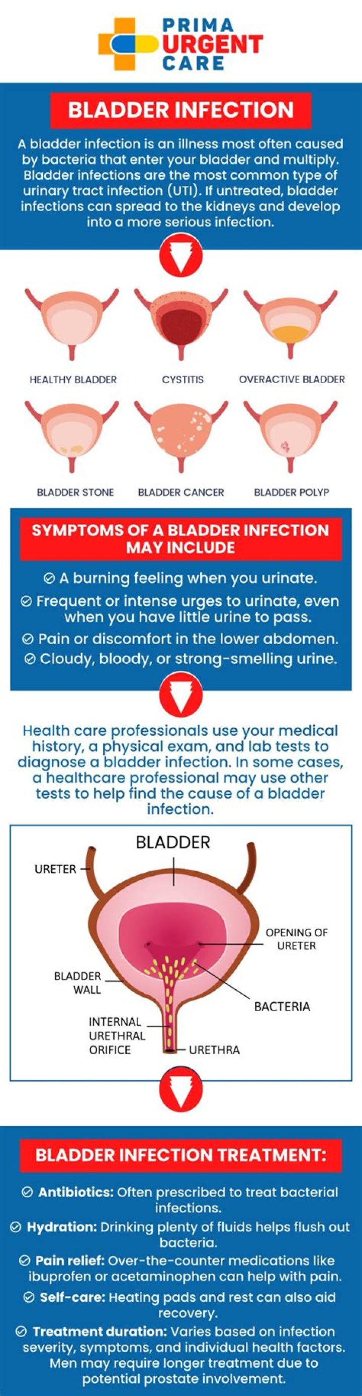Can a bladder infection go away on its own?