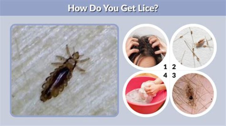 Can body lice jump?