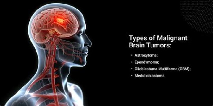 Can brain tumor lead to death?
