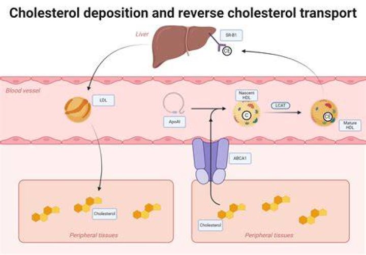 Can cholesterol reversed?