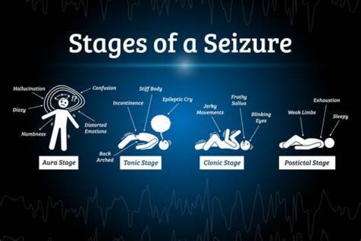 Can you hear during seizure?