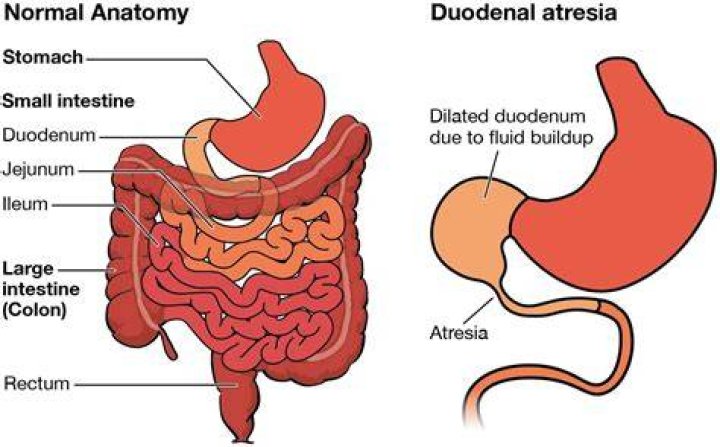 Do bowels slow down with age?