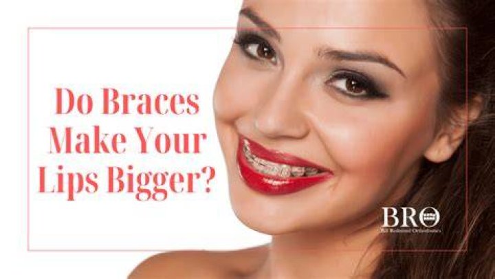 Do dentures make your lips bigger?