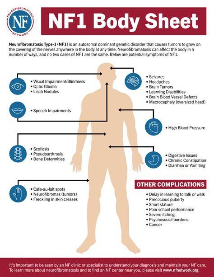 Do I have NF1?