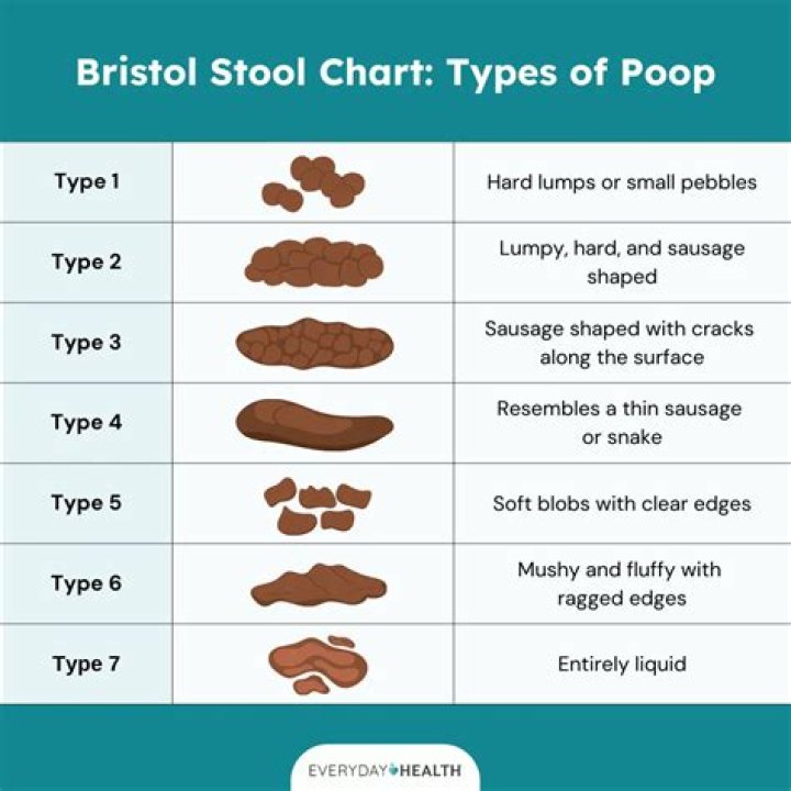 Do you poop more with IBS?