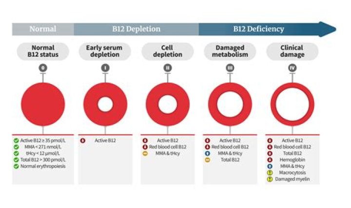 Does B12 deficiency cause weightloss?