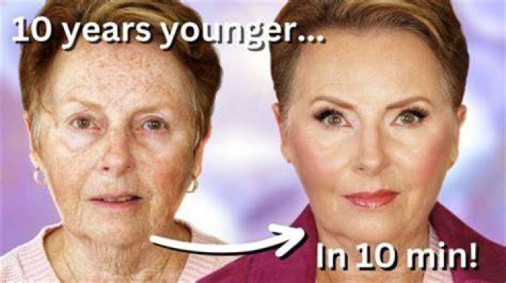How can I look 10 years younger without surgery?