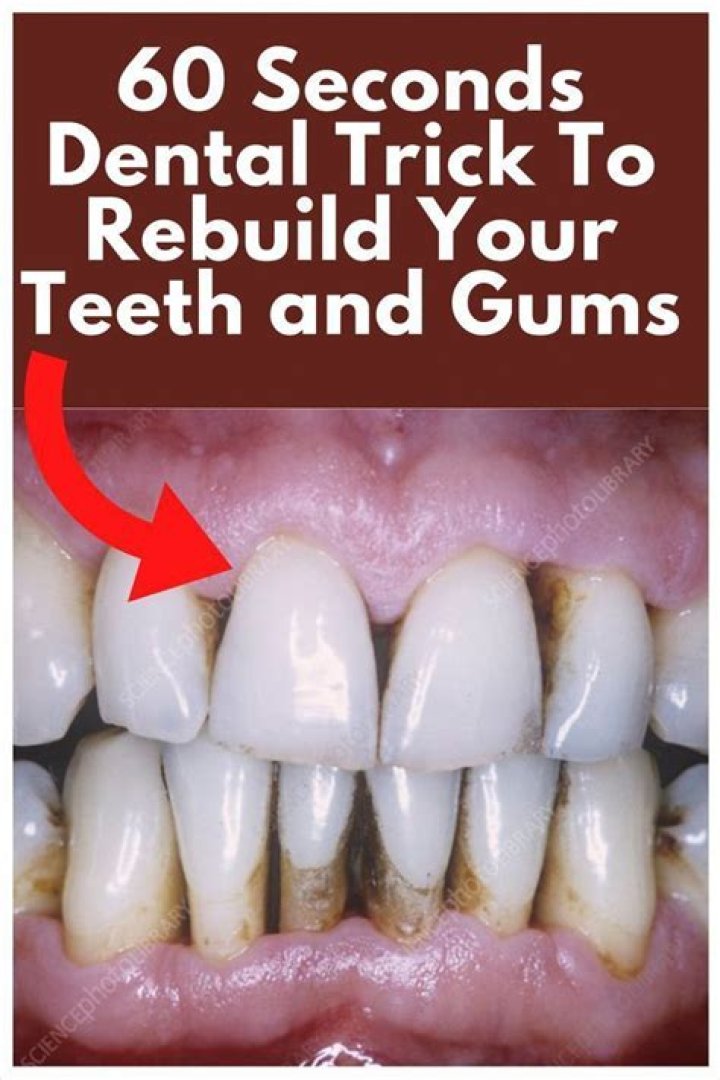 How can I rebuild my teeth naturally?