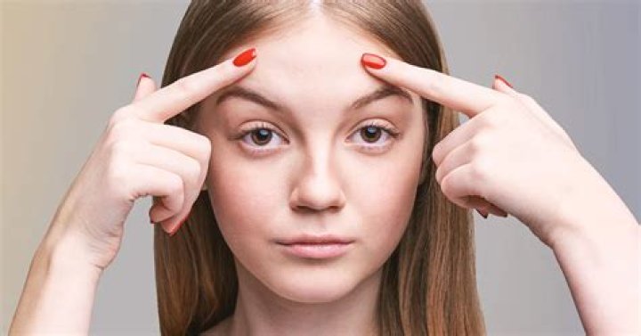 How do I get a shiny forehead?