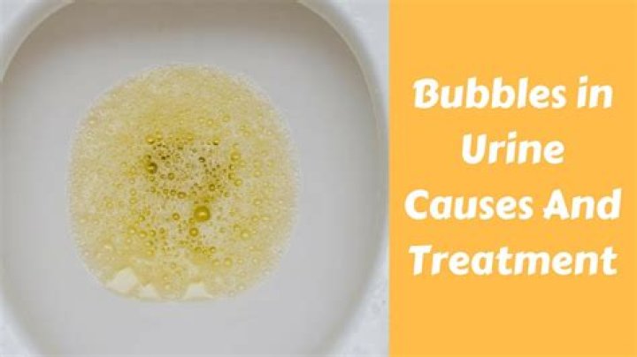 How do I get rid of bubbles in my urine?