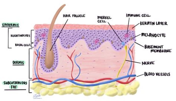 How do you describe a dermatofibroma?