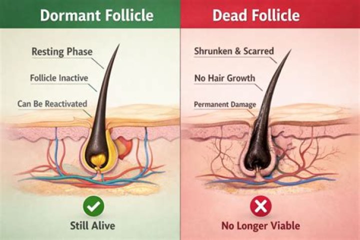 How do you stimulate a dead hair follicle?