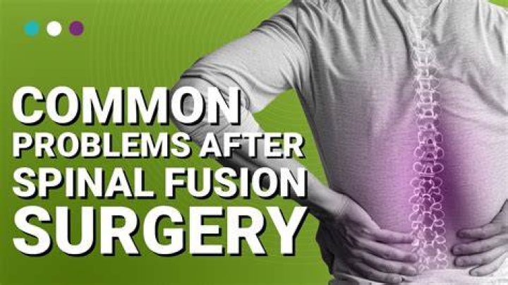 How long are you in the hospital after a spinal fusion?