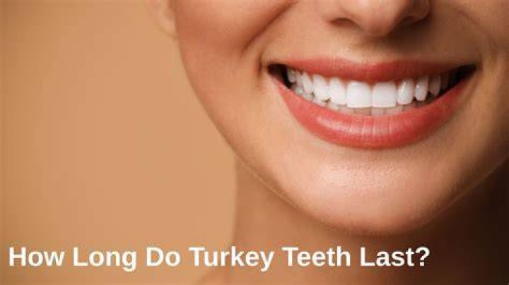 How long do Turkey teeth last?