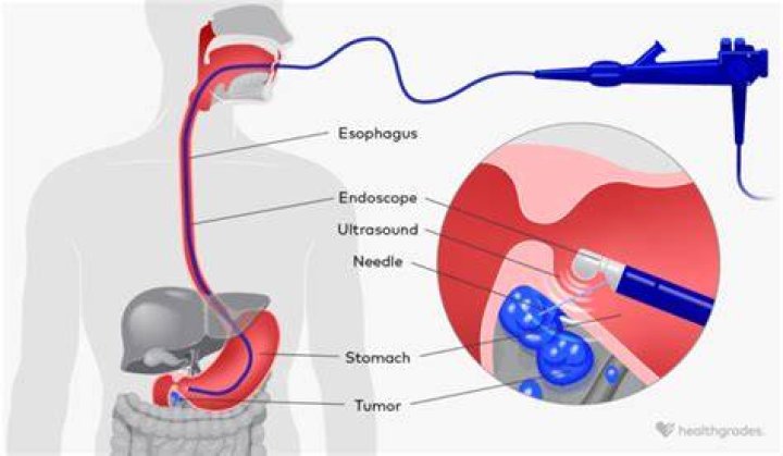 How long is sleep for endoscopy?