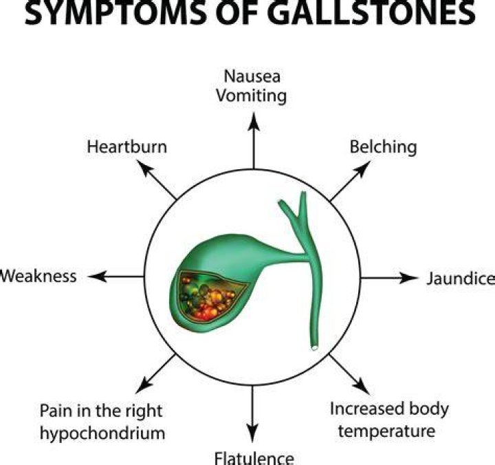 Is gallstone pain constant?