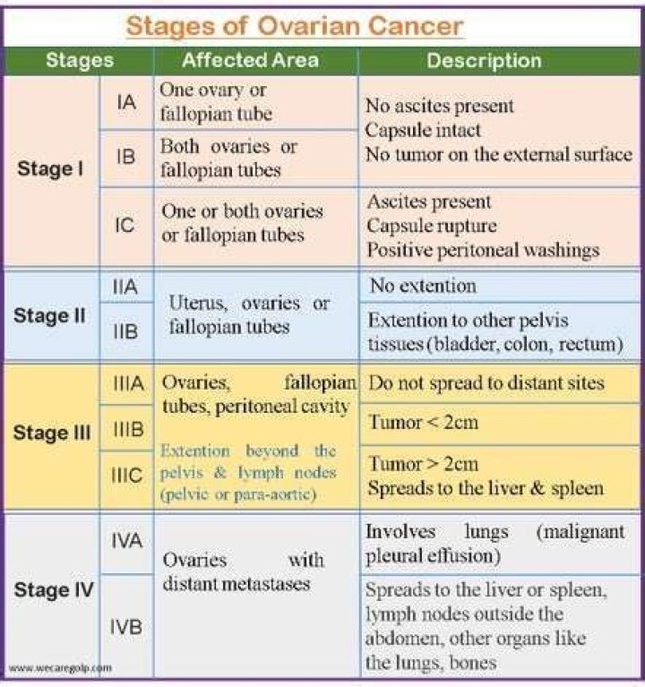 Is Stage 4 ovarian cancer curable?