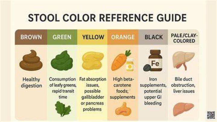 What color is stool with gallbladder problems?