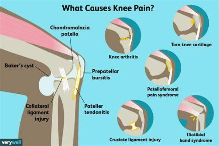 What deficiency causes knee pain?