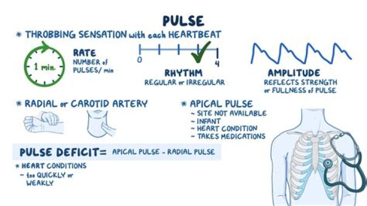 What does a weak pulse feel like?