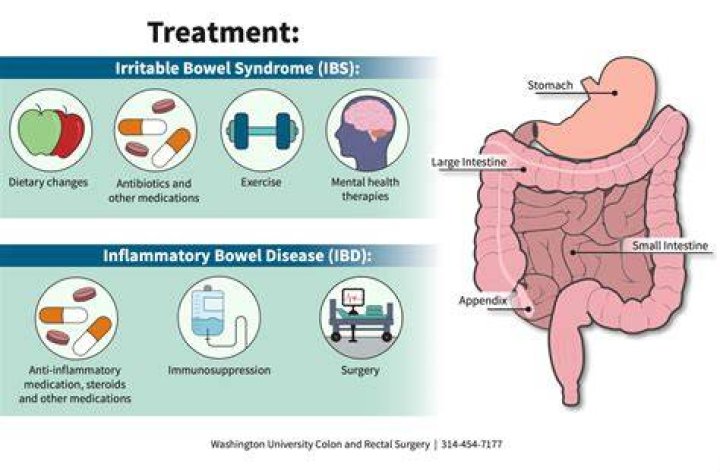 What does inflammation of the bowel feel like?