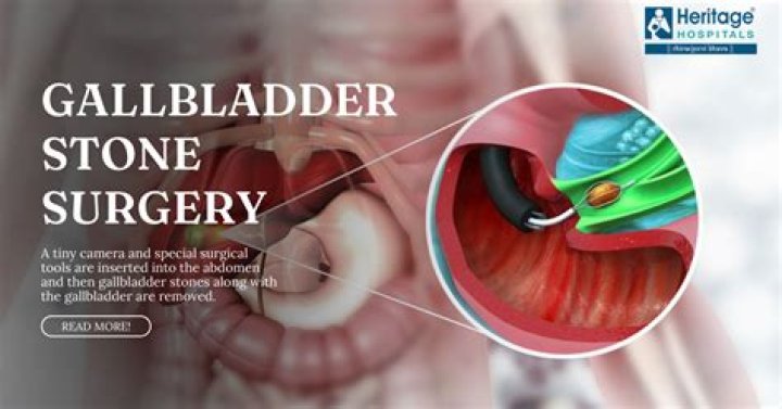 What qualifies for emergency gallbladder surgery?