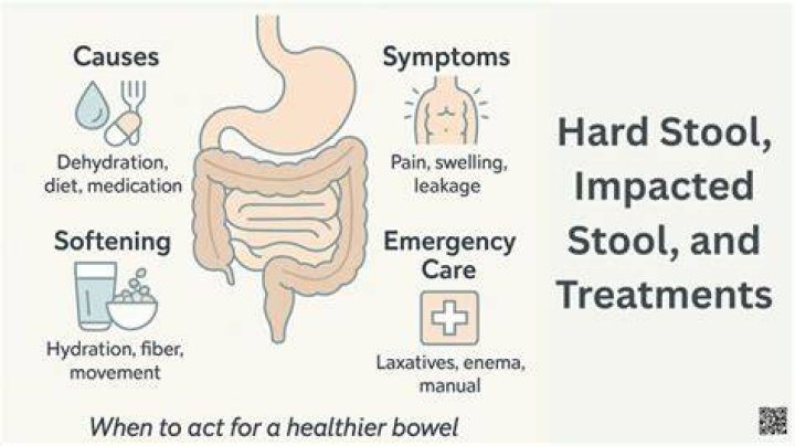 When should I go to ER for impacted bowel?
