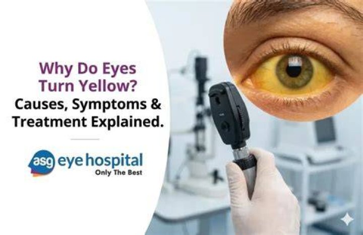 Why do eyes turn me?