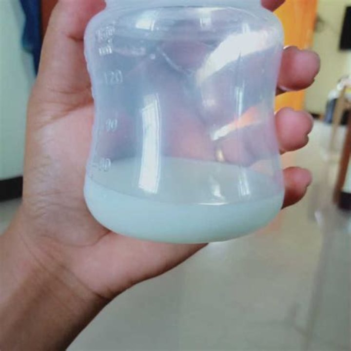 Why is my breastmilk clear and watery?