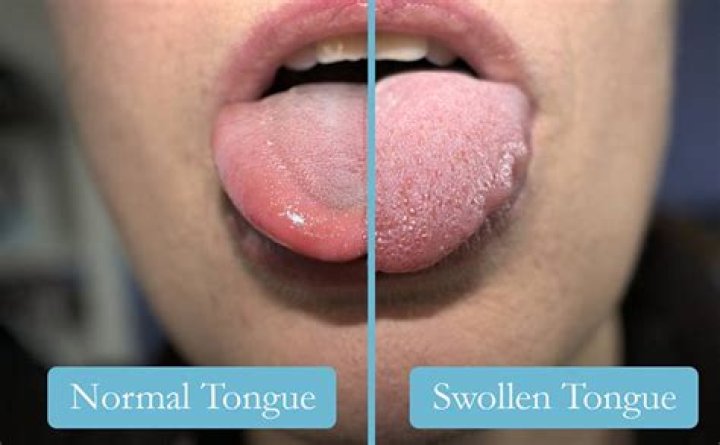 Why is my tongue dirty?
